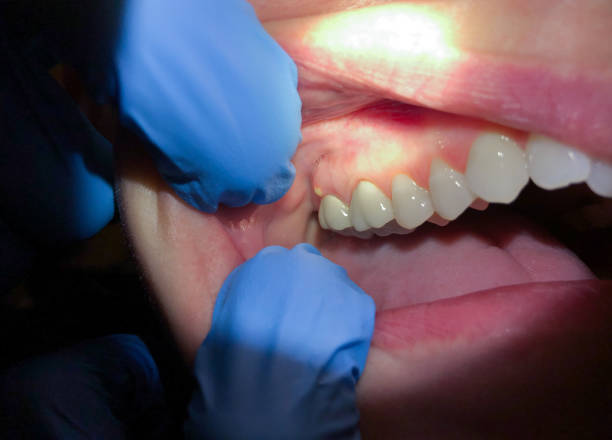 Best Emergency Broken Tooth Repair in Banner Hill, TN