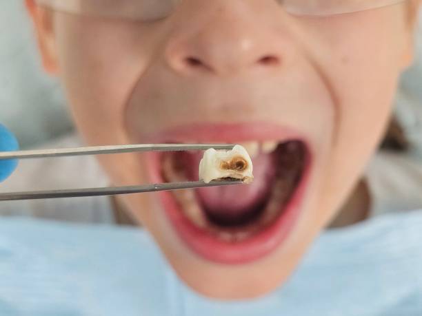 Best Emergency Orthodontic Repairs in Banner Hill, TN